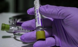 Koronavirus testi bu hallarda yanlış göstərə bilər