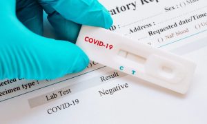 Apteklərdə satılan koronavirus testləri nə dərəcədə etibarlıdır? – TƏBİB açıqladı